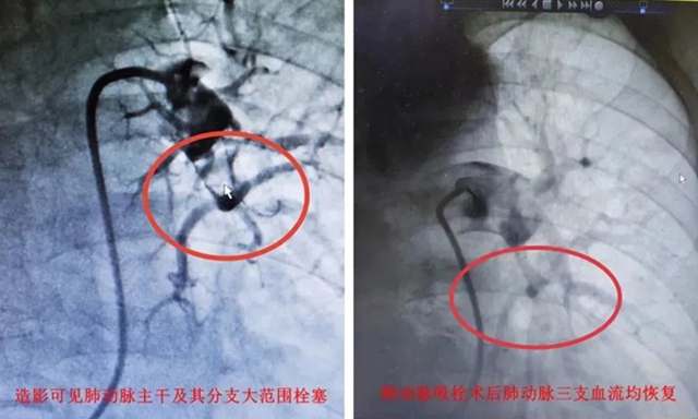 1673581684496.jpg 微信图片_20230113114611.jpg