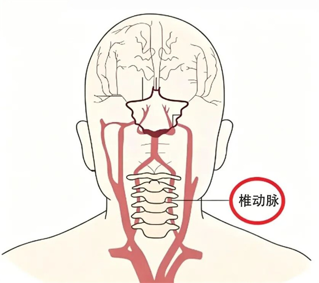 2136f206-7e51-485e-a300-ba52ceb03fa5.jpg